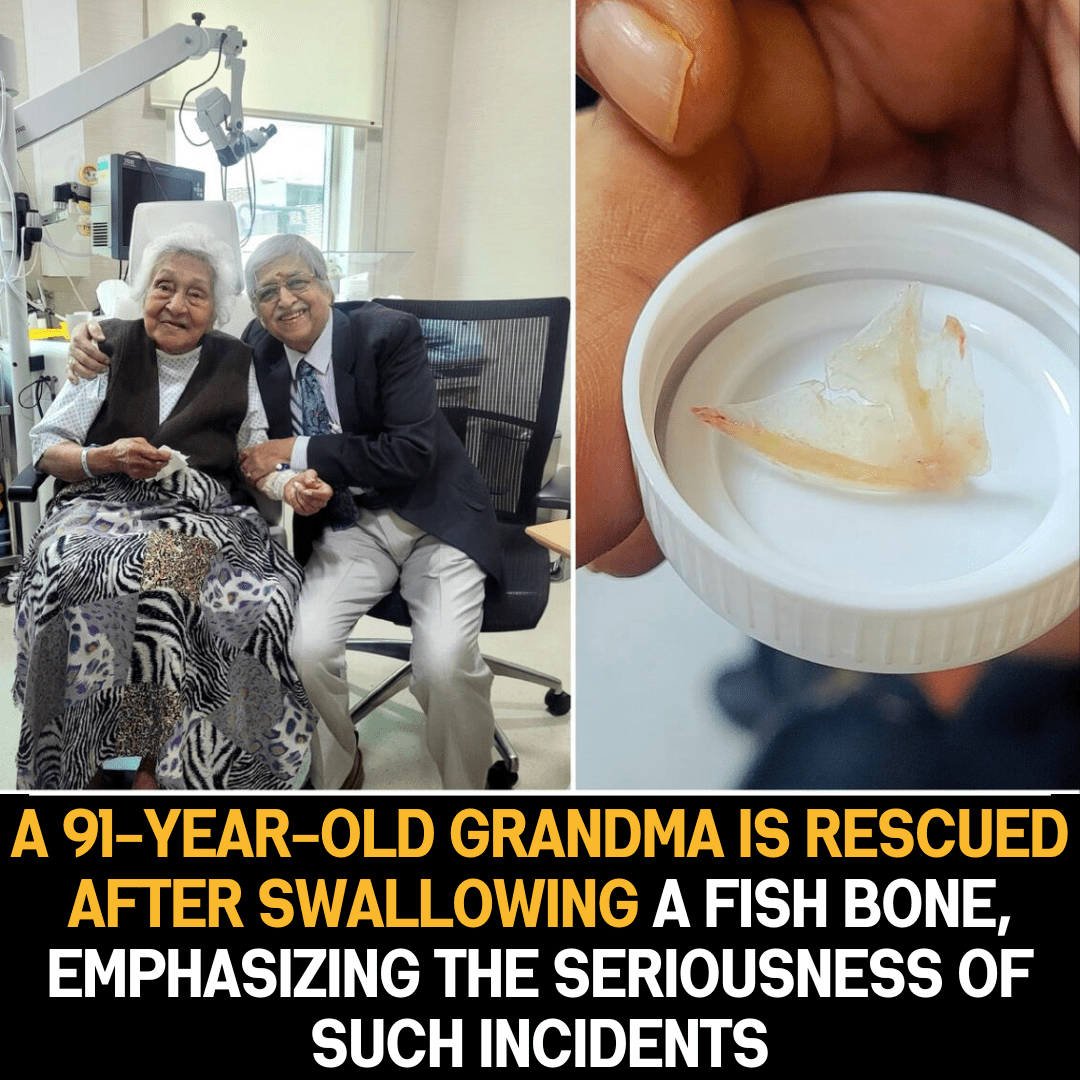 Elderly Woman’s Rescue from Swallowed Fish Bone Highlights Serious Health Risks