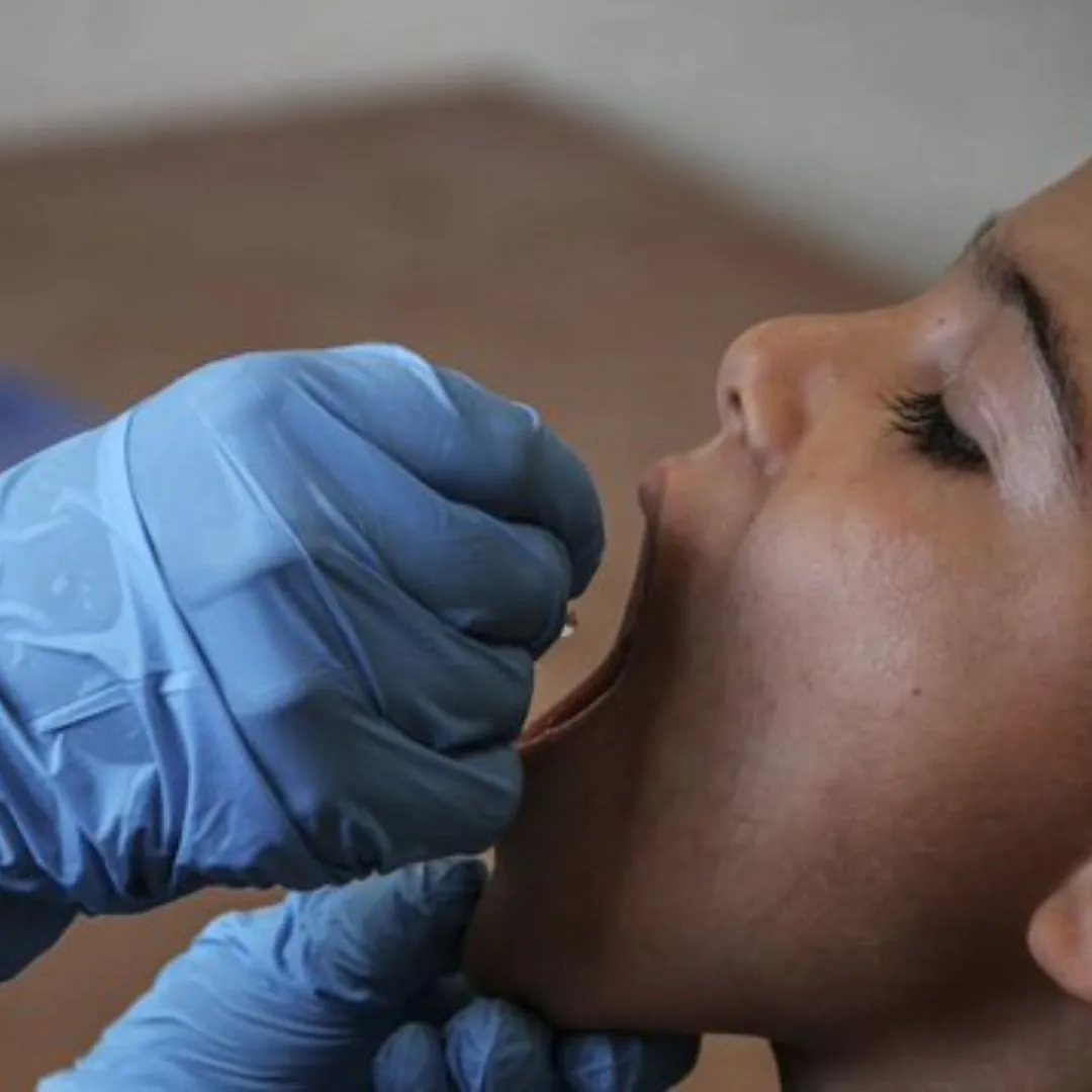 Gaza’s polio vaccination campaign surpassed initial targets, reaching more children than planned and enhancing public health